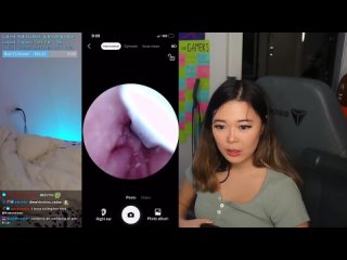 see inside my belly button  )   ear canal   belly button stream trim22